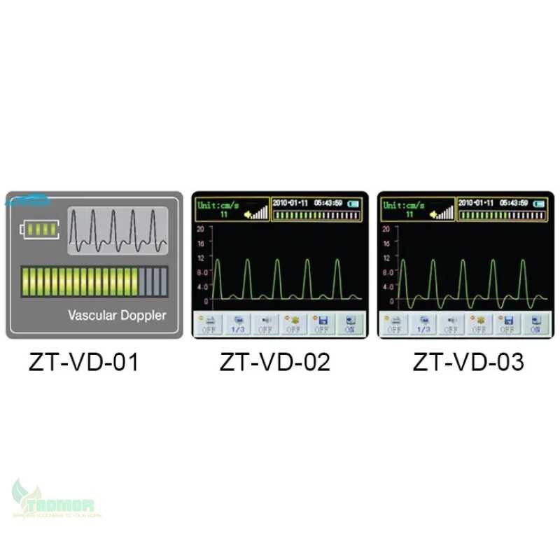 ZT-VD-01 Detect Arterial And Venous Blood Flow Velocity Portable mini Doppler Fetal Handheld Vascular Doppler - Image 5